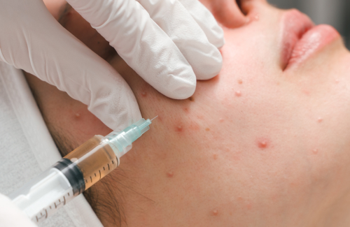 Hair fall treatment consultation at The Skin Sensé Hyderabad