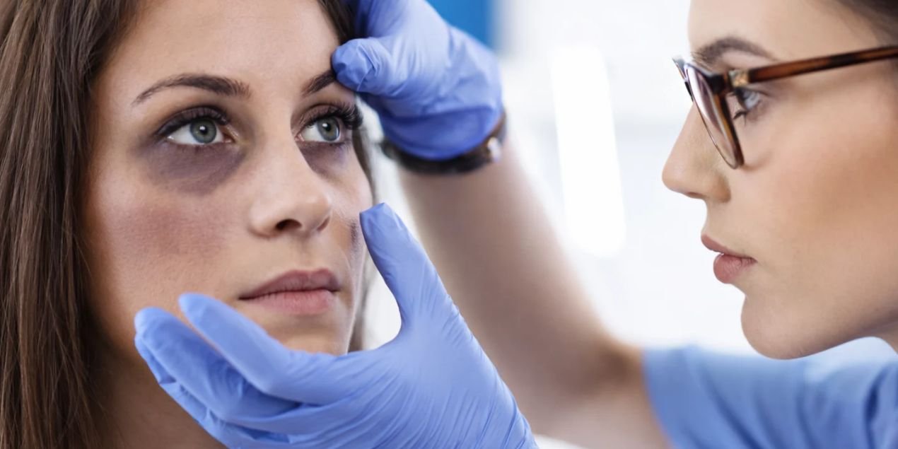 Does Vitamin C Help With Dark Circles? What Dermatologists Say - The Skin Sensé Blog
