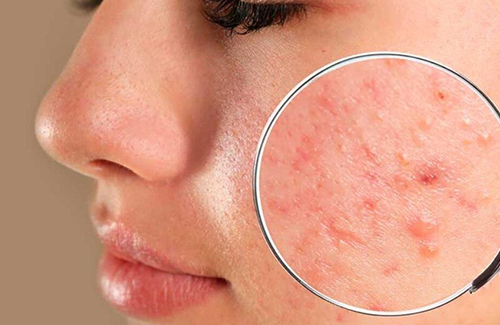 How to Use Sea Moss for Skincare - Face Mask Application