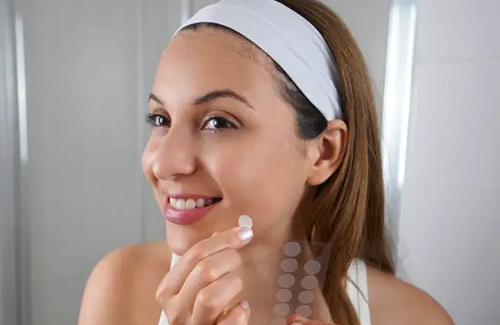 How to Apply Pimple Patches Correctly for Best Results