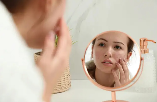 Pimple Patch Results - Before and After Treatment