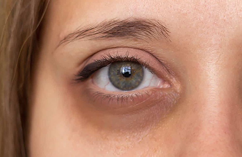 How to Apply Vitamin C Serum for Dark Circles