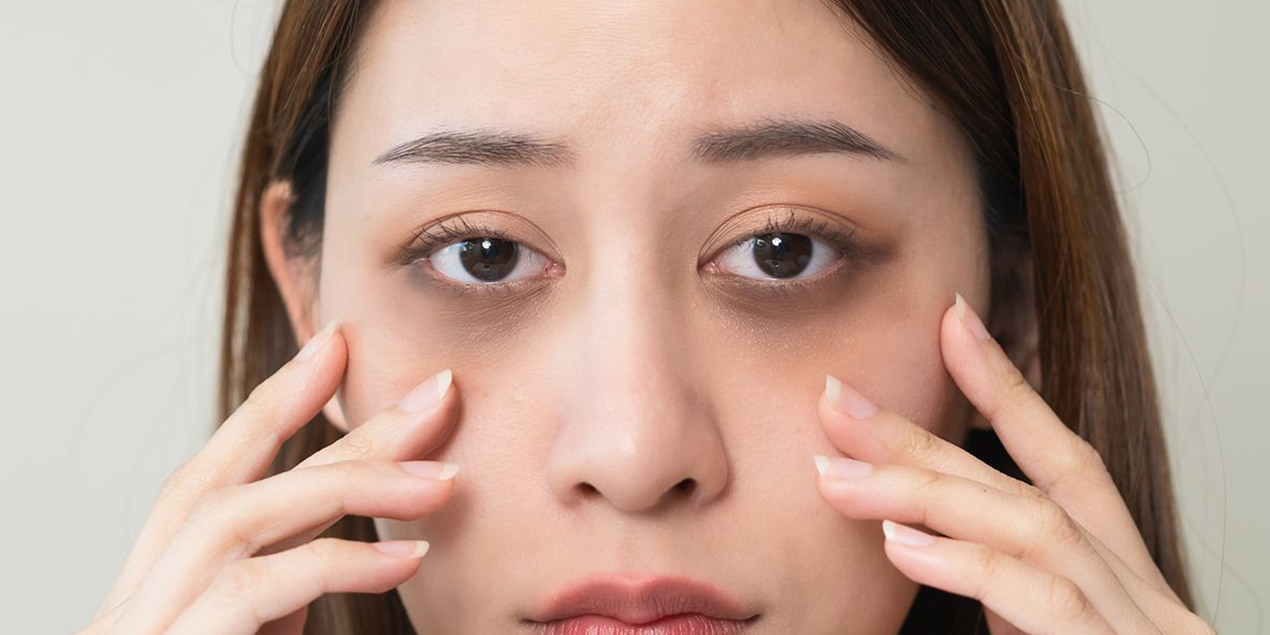 Reduce Dark Circles & Brighten Skin with Vitamin C - The Skin Sensé Blog