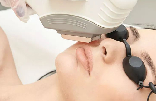 Laser Hair Removal Results